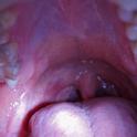 inside of a wide open mouth