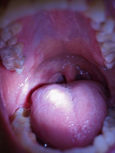 inside of a wide open mouth